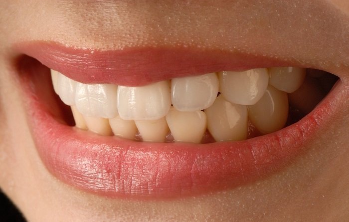 What Are The Worst Foods For Your Teeth bad foods for teeth