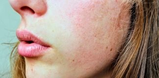 Learn How To Do Microdermabrasion At Home
