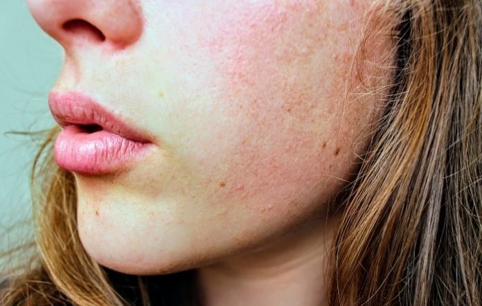 Learn How To Do Microdermabrasion At Home Learn How To Do Microdermabrasion At Home