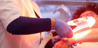 Which Type of Laser Hair Removal is Best for You