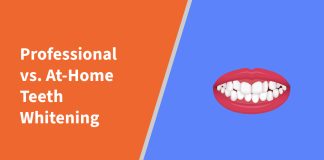 Professional vs. At-Home Teeth Whitening