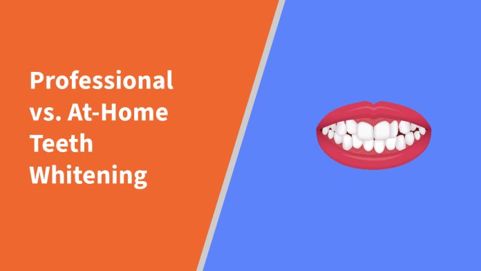 professional-vs-at-home-teeth-whitening Professional vs. At-Home Teeth Whitening